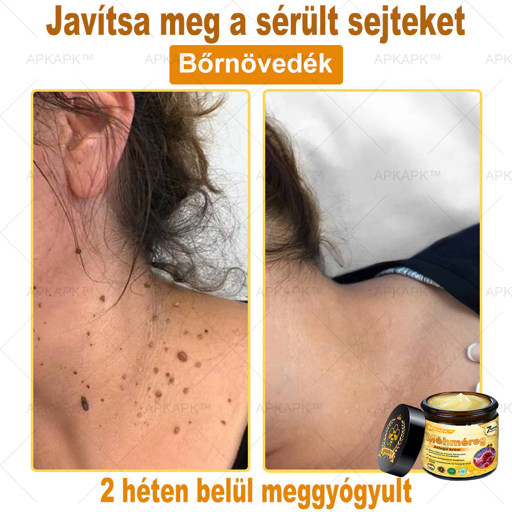 đ MĂĄr csak 5 doboz maradt! Most tovĂĄbbi 50% kedvezmĂ©nyt adunk! LegyĂ©l fitt Ă©s egĂ©szsĂ©ges.