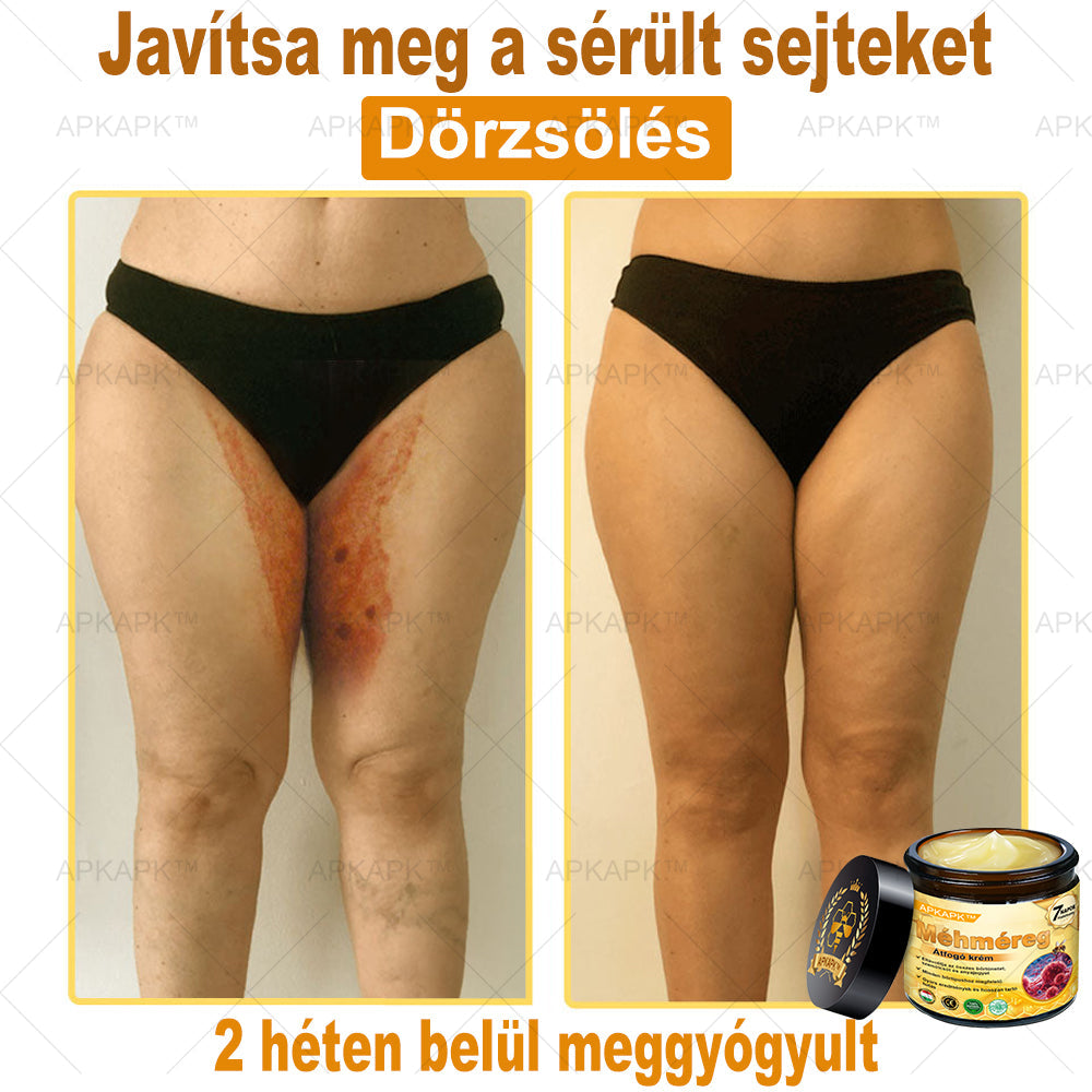 𝐀𝐏𝐊𝐀𝐏𝐊® 𝐌É𝐇𝐌É𝐑𝐄𝐆 Á𝐓𝐅𝐎𝐆Ó 𝐊𝐑É𝐌🥇𝐀 𝐛ö𝐫𝐩𝐫𝐨𝐛𝐥é𝐦á𝐤 𝐤𝐞𝐳𝐞𝐥é𝐬𝐞 𝐦𝐚𝐠á𝐛𝐚𝐧 𝐟𝐨𝐠𝐥𝐚𝐥𝐣𝐚: é𝐥𝐞𝐭𝐤𝐨𝐫𝐢 𝐟𝐨𝐥𝐭𝐨𝐤, 𝐡𝐞𝐠𝐞𝐤, 𝐬𝐳𝐞𝐦ö𝐥𝐜𝐬ö𝐤, 𝐛ö𝐫𝐧ö𝐯𝐞𝐝é𝐤𝐞𝐤, 𝐭á𝐥𝐲𝐨𝐠𝐨𝐤, 𝐩𝐚𝐭𝐭𝐚𝐧á𝐬𝐨𝐤, 𝐞𝐤𝐜é𝐦𝐚, 𝐩𝐬𝐨𝐫𝐢𝐚𝐬𝐢𝐬, 𝐚𝐜𝐧𝐞 𝐢𝐧𝐯𝐞𝐫𝐬𝐚, 𝐫á𝐧𝐜𝐨𝐤, 𝐛ö𝐫ö𝐫𝐞𝐠𝐞𝐝é𝐬 é𝐬 𝐞𝐠𝐲é𝐛 𝐩𝐫𝐨𝐛𝐥é𝐦á𝐤🔥