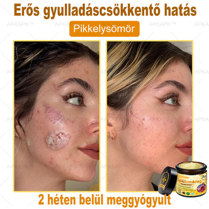 𝐀𝐏𝐊𝐀𝐏𝐊® 𝐌É𝐇𝐌É𝐑𝐄𝐆 Á𝐓𝐅𝐎𝐆Ó 𝐊𝐑É𝐌🥇𝐀 𝐛ö𝐫𝐩𝐫𝐨𝐛𝐥é𝐦á𝐤 𝐤𝐞𝐳𝐞𝐥é𝐬𝐞 𝐦𝐚𝐠á𝐛𝐚𝐧 𝐟𝐨𝐠𝐥𝐚𝐥𝐣𝐚: é𝐥𝐞𝐭𝐤𝐨𝐫𝐢 𝐟𝐨𝐥𝐭𝐨𝐤, 𝐡𝐞𝐠𝐞𝐤, 𝐬𝐳𝐞𝐦ö𝐥𝐜𝐬ö𝐤, 𝐛ö𝐫𝐧ö𝐯𝐞𝐝é𝐤𝐞𝐤, 𝐭á𝐥𝐲𝐨𝐠𝐨𝐤, 𝐩𝐚𝐭𝐭𝐚𝐧á𝐬𝐨𝐤, 𝐞𝐤𝐜é𝐦𝐚, 𝐩𝐬𝐨𝐫𝐢𝐚𝐬𝐢𝐬, 𝐚𝐜𝐧𝐞 𝐢𝐧𝐯𝐞𝐫𝐬𝐚, 𝐫á𝐧𝐜𝐨𝐤, 𝐛ö𝐫ö𝐫𝐞𝐠𝐞𝐝é𝐬 é𝐬 𝐞𝐠𝐲é𝐛 𝐩𝐫𝐨𝐛𝐥é𝐦á𝐤🔥