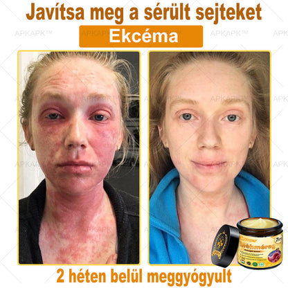 𝐀𝐏𝐊𝐀𝐏𝐊® 𝐌É𝐇𝐌É𝐑𝐄𝐆 Á𝐓𝐅𝐎𝐆Ó 𝐊𝐑É𝐌🥇𝐀 𝐛ö𝐫𝐩𝐫𝐨𝐛𝐥é𝐦á𝐤 𝐤𝐞𝐳𝐞𝐥é𝐬𝐞 𝐦𝐚𝐠á𝐛𝐚𝐧 𝐟𝐨𝐠𝐥𝐚𝐥𝐣𝐚: é𝐥𝐞𝐭𝐤𝐨𝐫𝐢 𝐟𝐨𝐥𝐭𝐨𝐤, 𝐡𝐞𝐠𝐞𝐤, 𝐬𝐳𝐞𝐦ö𝐥𝐜𝐬ö𝐤, 𝐛ö𝐫𝐧ö𝐯𝐞𝐝é𝐤𝐞𝐤, 𝐭á𝐥𝐲𝐨𝐠𝐨𝐤, 𝐩𝐚𝐭𝐭𝐚𝐧á𝐬𝐨𝐤, 𝐞𝐤𝐜é𝐦𝐚, 𝐩𝐬𝐨𝐫𝐢𝐚𝐬𝐢𝐬, 𝐚𝐜𝐧𝐞 𝐢𝐧𝐯𝐞𝐫𝐬𝐚, 𝐫á𝐧𝐜𝐨𝐤, 𝐛ö𝐫ö𝐫𝐞𝐠𝐞𝐝é𝐬 é𝐬 𝐞𝐠𝐲é𝐛 𝐩𝐫𝐨𝐛𝐥é𝐦á𝐤🔥