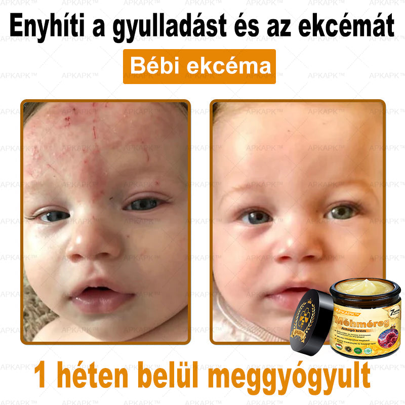 𝐀𝐏𝐊𝐀𝐏𝐊® 𝐌É𝐇𝐌É𝐑𝐄𝐆 Á𝐓𝐅𝐎𝐆Ó 𝐊𝐑É𝐌🥇𝐀 𝐛ö𝐫𝐩𝐫𝐨𝐛𝐥é𝐦á𝐤 𝐤𝐞𝐳𝐞𝐥é𝐬𝐞 𝐦𝐚𝐠á𝐛𝐚𝐧 𝐟𝐨𝐠𝐥𝐚𝐥𝐣𝐚: é𝐥𝐞𝐭𝐤𝐨𝐫𝐢 𝐟𝐨𝐥𝐭𝐨𝐤, 𝐡𝐞𝐠𝐞𝐤, 𝐬𝐳𝐞𝐦ö𝐥𝐜𝐬ö𝐤, 𝐛ö𝐫𝐧ö𝐯𝐞𝐝é𝐤𝐞𝐤, 𝐭á𝐥𝐲𝐨𝐠𝐨𝐤, 𝐩𝐚𝐭𝐭𝐚𝐧á𝐬𝐨𝐤, 𝐞𝐤𝐜é𝐦𝐚, 𝐩𝐬𝐨𝐫𝐢𝐚𝐬𝐢𝐬, 𝐚𝐜𝐧𝐞 𝐢𝐧𝐯𝐞𝐫𝐬𝐚, 𝐫á𝐧𝐜𝐨𝐤, 𝐛ö𝐫ö𝐫𝐞𝐠𝐞𝐝é𝐬 é𝐬 𝐞𝐠𝐲é𝐛 𝐩𝐫𝐨𝐛𝐥é𝐦á𝐤🔥