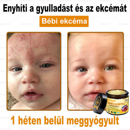 𝐀𝐏𝐊𝐀𝐏𝐊® 𝐌É𝐇𝐌É𝐑𝐄𝐆 Á𝐓𝐅𝐎𝐆Ó 𝐊𝐑É𝐌🥇𝐀 𝐛ö𝐫𝐩𝐫𝐨𝐛𝐥é𝐦á𝐤 𝐤𝐞𝐳𝐞𝐥é𝐬𝐞 𝐦𝐚𝐠á𝐛𝐚𝐧 𝐟𝐨𝐠𝐥𝐚𝐥𝐣𝐚: é𝐥𝐞𝐭𝐤𝐨𝐫𝐢 𝐟𝐨𝐥𝐭𝐨𝐤, 𝐡𝐞𝐠𝐞𝐤, 𝐬𝐳𝐞𝐦ö𝐥𝐜𝐬ö𝐤, 𝐛ö𝐫𝐧ö𝐯𝐞𝐝é𝐤𝐞𝐤, 𝐭á𝐥𝐲𝐨𝐠𝐨𝐤, 𝐩𝐚𝐭𝐭𝐚𝐧á𝐬𝐨𝐤, 𝐞𝐤𝐜é𝐦𝐚, 𝐩𝐬𝐨𝐫𝐢𝐚𝐬𝐢𝐬, 𝐚𝐜𝐧𝐞 𝐢𝐧𝐯𝐞𝐫𝐬𝐚, 𝐫á𝐧𝐜𝐨𝐤, 𝐛ö𝐫ö𝐫𝐞𝐠𝐞𝐝é𝐬 é𝐬 𝐞𝐠𝐲é𝐛 𝐩𝐫𝐨𝐛𝐥é𝐦á𝐤🔥