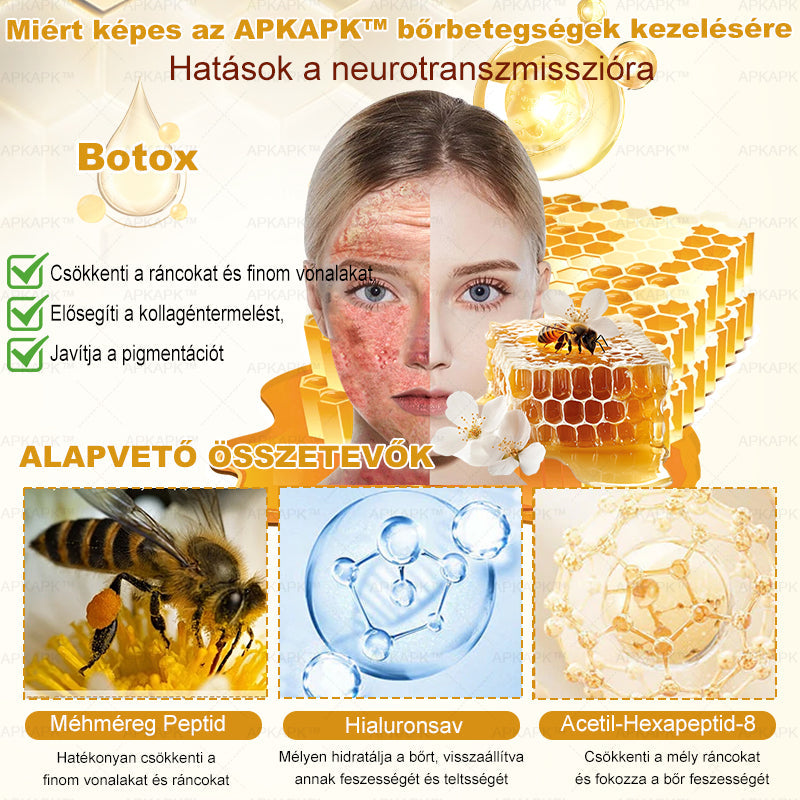 𝐀𝐏𝐊𝐀𝐏𝐊® 𝐌É𝐇𝐌É𝐑𝐄𝐆 Á𝐓𝐅𝐎𝐆Ó 𝐊𝐑É𝐌🥇𝐀 𝐛ö𝐫𝐩𝐫𝐨𝐛𝐥é𝐦á𝐤 𝐤𝐞𝐳𝐞𝐥é𝐬𝐞 𝐦𝐚𝐠á𝐛𝐚𝐧 𝐟𝐨𝐠𝐥𝐚𝐥𝐣𝐚: é𝐥𝐞𝐭𝐤𝐨𝐫𝐢 𝐟𝐨𝐥𝐭𝐨𝐤, 𝐡𝐞𝐠𝐞𝐤, 𝐬𝐳𝐞𝐦ö𝐥𝐜𝐬ö𝐤, 𝐛ö𝐫𝐧ö𝐯𝐞𝐝é𝐤𝐞𝐤, 𝐭á𝐥𝐲𝐨𝐠𝐨𝐤, 𝐩𝐚𝐭𝐭𝐚𝐧á𝐬𝐨𝐤, 𝐞𝐤𝐜é𝐦𝐚, 𝐩𝐬𝐨𝐫𝐢𝐚𝐬𝐢𝐬, 𝐚𝐜𝐧𝐞 𝐢𝐧𝐯𝐞𝐫𝐬𝐚, 𝐫á𝐧𝐜𝐨𝐤, 𝐛ö𝐫ö𝐫𝐞𝐠𝐞𝐝é𝐬 é𝐬 𝐞𝐠𝐲é𝐛 𝐩𝐫𝐨𝐛𝐥é𝐦á𝐤🔥