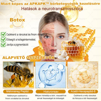 𝐀𝐏𝐊𝐀𝐏𝐊® 𝐌É𝐇𝐌É𝐑𝐄𝐆 Á𝐓𝐅𝐎𝐆Ó 𝐊𝐑É𝐌🥇𝐀 𝐛ö𝐫𝐩𝐫𝐨𝐛𝐥é𝐦á𝐤 𝐤𝐞𝐳𝐞𝐥é𝐬𝐞 𝐦𝐚𝐠á𝐛𝐚𝐧 𝐟𝐨𝐠𝐥𝐚𝐥𝐣𝐚: é𝐥𝐞𝐭𝐤𝐨𝐫𝐢 𝐟𝐨𝐥𝐭𝐨𝐤, 𝐡𝐞𝐠𝐞𝐤, 𝐬𝐳𝐞𝐦ö𝐥𝐜𝐬ö𝐤, 𝐛ö𝐫𝐧ö𝐯𝐞𝐝é𝐤𝐞𝐤, 𝐭á𝐥𝐲𝐨𝐠𝐨𝐤, 𝐩𝐚𝐭𝐭𝐚𝐧á𝐬𝐨𝐤, 𝐞𝐤𝐜é𝐦𝐚, 𝐩𝐬𝐨𝐫𝐢𝐚𝐬𝐢𝐬, 𝐚𝐜𝐧𝐞 𝐢𝐧𝐯𝐞𝐫𝐬𝐚, 𝐫á𝐧𝐜𝐨𝐤, 𝐛ö𝐫ö𝐫𝐞𝐠𝐞𝐝é𝐬 é𝐬 𝐞𝐠𝐲é𝐛 𝐩𝐫𝐨𝐛𝐥é𝐦á𝐤🔥