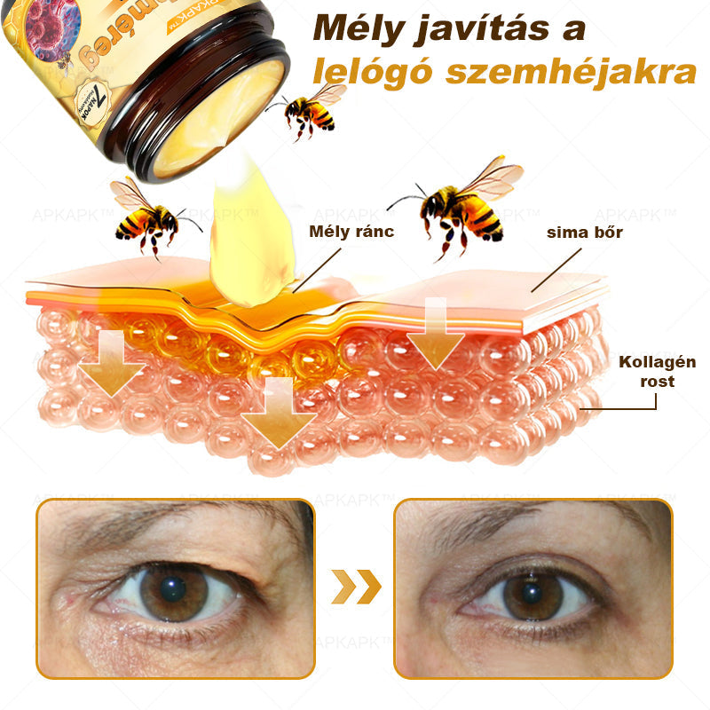 𝐀𝐏𝐊𝐀𝐏𝐊® 𝐌É𝐇𝐌É𝐑𝐄𝐆 Á𝐓𝐅𝐎𝐆Ó 𝐊𝐑É𝐌🥇𝐀 𝐛ö𝐫𝐩𝐫𝐨𝐛𝐥é𝐦á𝐤 𝐤𝐞𝐳𝐞𝐥é𝐬𝐞 𝐦𝐚𝐠á𝐛𝐚𝐧 𝐟𝐨𝐠𝐥𝐚𝐥𝐣𝐚: é𝐥𝐞𝐭𝐤𝐨𝐫𝐢 𝐟𝐨𝐥𝐭𝐨𝐤, 𝐡𝐞𝐠𝐞𝐤, 𝐬𝐳𝐞𝐦ö𝐥𝐜𝐬ö𝐤, 𝐛ö𝐫𝐧ö𝐯𝐞𝐝é𝐤𝐞𝐤, 𝐭á𝐥𝐲𝐨𝐠𝐨𝐤, 𝐩𝐚𝐭𝐭𝐚𝐧á𝐬𝐨𝐤, 𝐞𝐤𝐜é𝐦𝐚, 𝐩𝐬𝐨𝐫𝐢𝐚𝐬𝐢𝐬, 𝐚𝐜𝐧𝐞 𝐢𝐧𝐯𝐞𝐫𝐬𝐚, 𝐫á𝐧𝐜𝐨𝐤, 𝐛ö𝐫ö𝐫𝐞𝐠𝐞𝐝é𝐬 é𝐬 𝐞𝐠𝐲é𝐛 𝐩𝐫𝐨𝐛𝐥é𝐦á𝐤🔥
