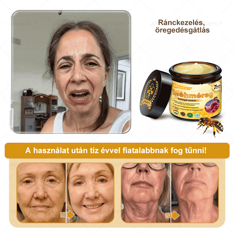 𝐀𝐏𝐊𝐀𝐏𝐊® 𝐌É𝐇𝐌É𝐑𝐄𝐆 Á𝐓𝐅𝐎𝐆Ó 𝐊𝐑É𝐌🥇𝐀 𝐛ö𝐫𝐩𝐫𝐨𝐛𝐥é𝐦á𝐤 𝐤𝐞𝐳𝐞𝐥é𝐬𝐞 𝐦𝐚𝐠á𝐛𝐚𝐧 𝐟𝐨𝐠𝐥𝐚𝐥𝐣𝐚: é𝐥𝐞𝐭𝐤𝐨𝐫𝐢 𝐟𝐨𝐥𝐭𝐨𝐤, 𝐡𝐞𝐠𝐞𝐤, 𝐬𝐳𝐞𝐦ö𝐥𝐜𝐬ö𝐤, 𝐛ö𝐫𝐧ö𝐯𝐞𝐝é𝐤𝐞𝐤, 𝐭á𝐥𝐲𝐨𝐠𝐨𝐤, 𝐩𝐚𝐭𝐭𝐚𝐧á𝐬𝐨𝐤, 𝐞𝐤𝐜é𝐦𝐚, 𝐩𝐬𝐨𝐫𝐢𝐚𝐬𝐢𝐬, 𝐚𝐜𝐧𝐞 𝐢𝐧𝐯𝐞𝐫𝐬𝐚, 𝐫á𝐧𝐜𝐨𝐤, 𝐛ö𝐫ö𝐫𝐞𝐠𝐞𝐝é𝐬 é𝐬 𝐞𝐠𝐲é𝐛 𝐩𝐫𝐨𝐛𝐥é𝐦á𝐤🔥