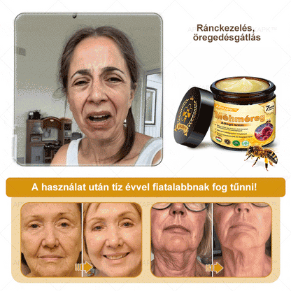 𝐀𝐏𝐊𝐀𝐏𝐊® 𝐌É𝐇𝐌É𝐑𝐄𝐆 Á𝐓𝐅𝐎𝐆Ó 𝐊𝐑É𝐌🥇𝐀 𝐛ö𝐫𝐩𝐫𝐨𝐛𝐥é𝐦á𝐤 𝐤𝐞𝐳𝐞𝐥é𝐬𝐞 𝐦𝐚𝐠á𝐛𝐚𝐧 𝐟𝐨𝐠𝐥𝐚𝐥𝐣𝐚: é𝐥𝐞𝐭𝐤𝐨𝐫𝐢 𝐟𝐨𝐥𝐭𝐨𝐤, 𝐡𝐞𝐠𝐞𝐤, 𝐬𝐳𝐞𝐦ö𝐥𝐜𝐬ö𝐤, 𝐛ö𝐫𝐧ö𝐯𝐞𝐝é𝐤𝐞𝐤, 𝐭á𝐥𝐲𝐨𝐠𝐨𝐤, 𝐩𝐚𝐭𝐭𝐚𝐧á𝐬𝐨𝐤, 𝐞𝐤𝐜é𝐦𝐚, 𝐩𝐬𝐨𝐫𝐢𝐚𝐬𝐢𝐬, 𝐚𝐜𝐧𝐞 𝐢𝐧𝐯𝐞𝐫𝐬𝐚, 𝐫á𝐧𝐜𝐨𝐤, 𝐛ö𝐫ö𝐫𝐞𝐠𝐞𝐝é𝐬 é𝐬 𝐞𝐠𝐲é𝐛 𝐩𝐫𝐨𝐛𝐥é𝐦á𝐤🔥