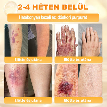 🎁 Már csak 5 doboz maradt! Most további 50% kedvezményt adunk! Legyél fitt és egészséges.