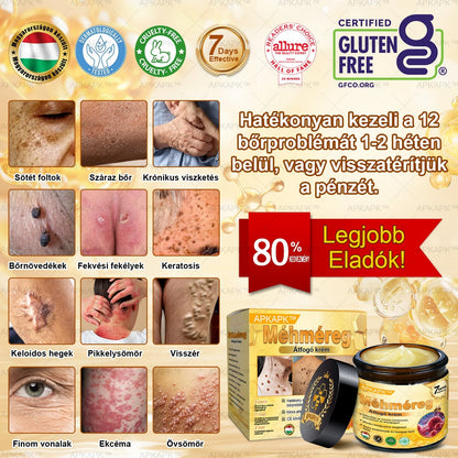 𝐀𝐏𝐊𝐀𝐏𝐊® 𝐌É𝐇𝐌É𝐑𝐄𝐆 Á𝐓𝐅𝐎𝐆Ó 𝐊𝐑É𝐌🥇𝐀 𝐛ö𝐫𝐩𝐫𝐨𝐛𝐥é𝐦á𝐤 𝐤𝐞𝐳𝐞𝐥é𝐬𝐞 𝐦𝐚𝐠á𝐛𝐚𝐧 𝐟𝐨𝐠𝐥𝐚𝐥𝐣𝐚: é𝐥𝐞𝐭𝐤𝐨𝐫𝐢 𝐟𝐨𝐥𝐭𝐨𝐤, 𝐡𝐞𝐠𝐞𝐤, 𝐬𝐳𝐞𝐦ö𝐥𝐜𝐬ö𝐤, 𝐛ö𝐫𝐧ö𝐯𝐞𝐝é𝐤𝐞𝐤, 𝐭á𝐥𝐲𝐨𝐠𝐨𝐤, 𝐩𝐚𝐭𝐭𝐚𝐧á𝐬𝐨𝐤, 𝐞𝐤𝐜é𝐦𝐚, 𝐩𝐬𝐨𝐫𝐢𝐚𝐬𝐢𝐬, 𝐚𝐜𝐧𝐞 𝐢𝐧𝐯𝐞𝐫𝐬𝐚, 𝐫á𝐧𝐜𝐨𝐤, 𝐛ö𝐫ö𝐫𝐞𝐠𝐞𝐝é𝐬 é𝐬 𝐞𝐠𝐲é𝐛 𝐩𝐫𝐨𝐛𝐥é𝐦á𝐤🔥