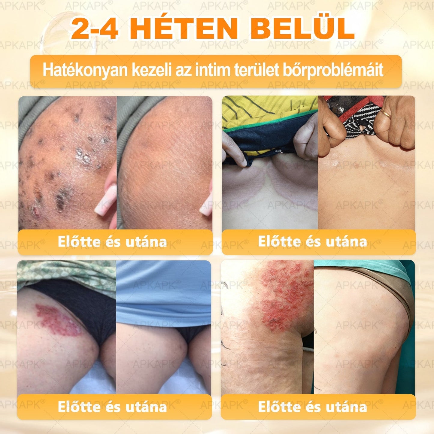 🎁 Már csak 5 doboz maradt! Most további 50% kedvezményt adunk! Legyél fitt és egészséges.