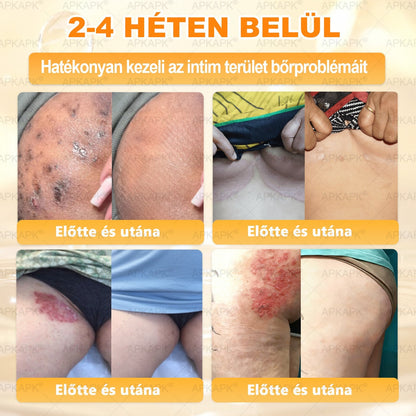 🎁 Már csak 5 doboz maradt! Most további 50% kedvezményt adunk! Legyél fitt és egészséges.