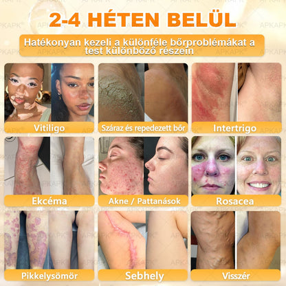 🎁 Már csak 5 doboz maradt! Most további 50% kedvezményt adunk! Legyél fitt és egészséges.