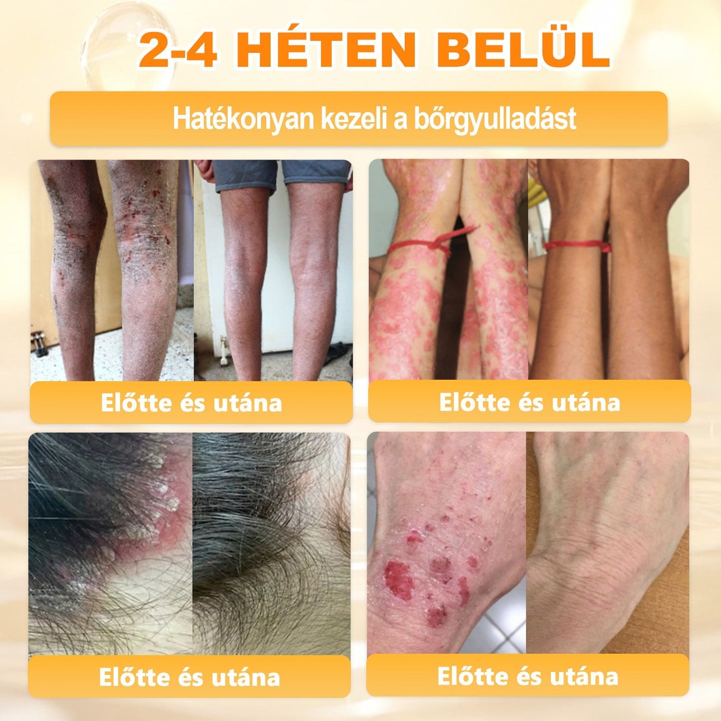 🎁 Már csak 5 doboz maradt! Most további 50% kedvezményt adunk! Legyél fitt és egészséges.