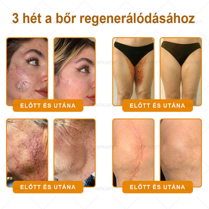 🎁 Már csak 5 doboz maradt! Most további 50% kedvezményt adunk! Legyél fitt és egészséges.