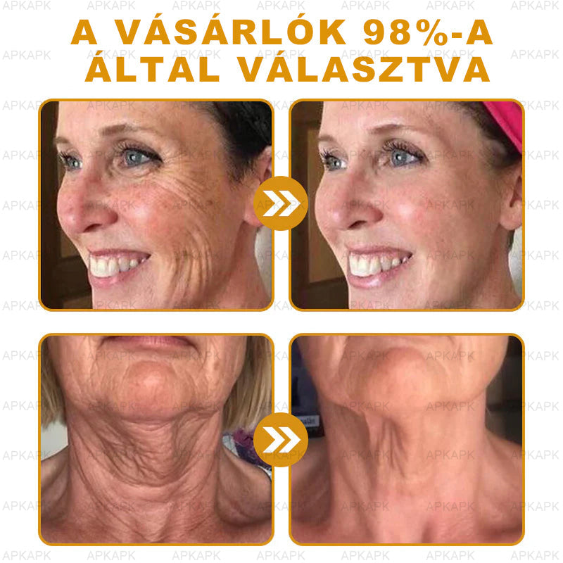 𝐀𝐏𝐊𝐀𝐏𝐊® 𝐌É𝐇𝐌É𝐑𝐄𝐆 Á𝐓𝐅𝐎𝐆Ó 𝐊𝐑É𝐌🥇𝐀 𝐛ö𝐫𝐩𝐫𝐨𝐛𝐥é𝐦á𝐤 𝐤𝐞𝐳𝐞𝐥é𝐬𝐞 𝐦𝐚𝐠á𝐛𝐚𝐧 𝐟𝐨𝐠𝐥𝐚𝐥𝐣𝐚: é𝐥𝐞𝐭𝐤𝐨𝐫𝐢 𝐟𝐨𝐥𝐭𝐨𝐤, 𝐡𝐞𝐠𝐞𝐤, 𝐬𝐳𝐞𝐦ö𝐥𝐜𝐬ö𝐤, 𝐛ö𝐫𝐧ö𝐯𝐞𝐝é𝐤𝐞𝐤, 𝐭á𝐥𝐲𝐨𝐠𝐨𝐤, 𝐩𝐚𝐭𝐭𝐚𝐧á𝐬𝐨𝐤, 𝐞𝐤𝐜é𝐦𝐚, 𝐩𝐬𝐨𝐫𝐢𝐚𝐬𝐢𝐬, 𝐚𝐜𝐧𝐞 𝐢𝐧𝐯𝐞𝐫𝐬𝐚, 𝐫á𝐧𝐜𝐨𝐤, 𝐛ö𝐫ö𝐫𝐞𝐠𝐞𝐝é𝐬 é𝐬 𝐞𝐠𝐲é𝐛 𝐩𝐫𝐨𝐛𝐥é𝐦á𝐤🔥