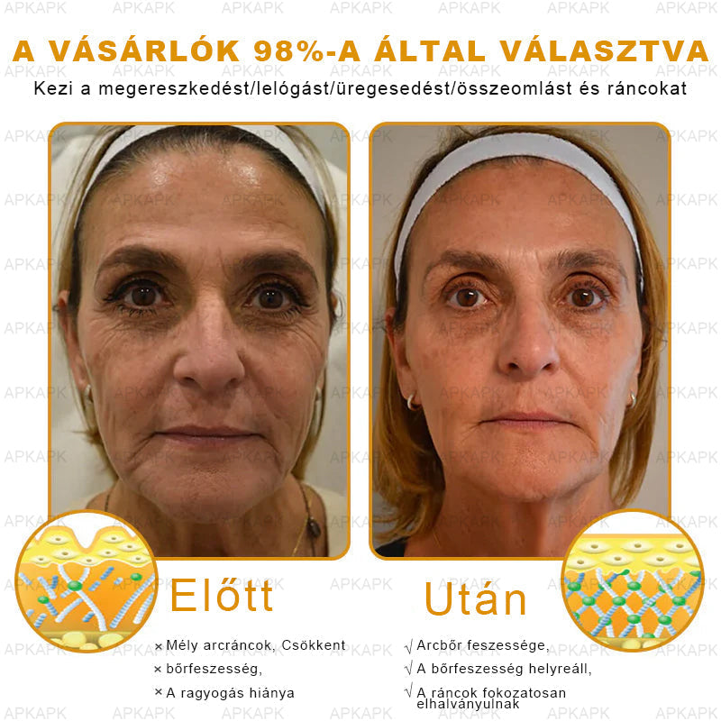 𝐀𝐏𝐊𝐀𝐏𝐊® 𝐌É𝐇𝐌É𝐑𝐄𝐆 Á𝐓𝐅𝐎𝐆Ó 𝐊𝐑É𝐌🥇𝐀 𝐛ö𝐫𝐩𝐫𝐨𝐛𝐥é𝐦á𝐤 𝐤𝐞𝐳𝐞𝐥é𝐬𝐞 𝐦𝐚𝐠á𝐛𝐚𝐧 𝐟𝐨𝐠𝐥𝐚𝐥𝐣𝐚: é𝐥𝐞𝐭𝐤𝐨𝐫𝐢 𝐟𝐨𝐥𝐭𝐨𝐤, 𝐡𝐞𝐠𝐞𝐤, 𝐬𝐳𝐞𝐦ö𝐥𝐜𝐬ö𝐤, 𝐛ö𝐫𝐧ö𝐯𝐞𝐝é𝐤𝐞𝐤, 𝐭á𝐥𝐲𝐨𝐠𝐨𝐤, 𝐩𝐚𝐭𝐭𝐚𝐧á𝐬𝐨𝐤, 𝐞𝐤𝐜é𝐦𝐚, 𝐩𝐬𝐨𝐫𝐢𝐚𝐬𝐢𝐬, 𝐚𝐜𝐧𝐞 𝐢𝐧𝐯𝐞𝐫𝐬𝐚, 𝐫á𝐧𝐜𝐨𝐤, 𝐛ö𝐫ö𝐫𝐞𝐠𝐞𝐝é𝐬 é𝐬 𝐞𝐠𝐲é𝐛 𝐩𝐫𝐨𝐛𝐥é𝐦á𝐤🔥